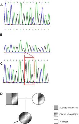 Case report: Sodium and chloride muscle channelopathy coexistence: A complicated phenotype and a challenging diagnosis